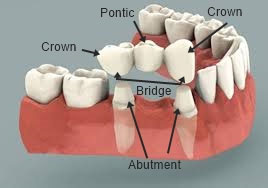 Cosmetic Dentist In Hill District: Considerations