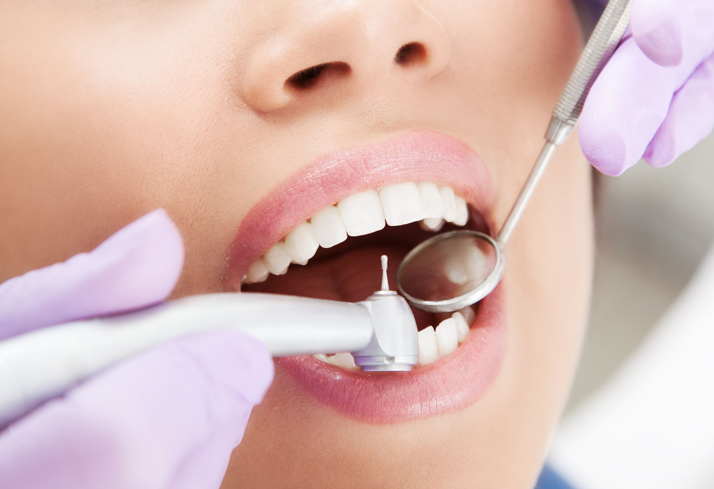 Cosmetic Dentist In Castle Hill: Benefits